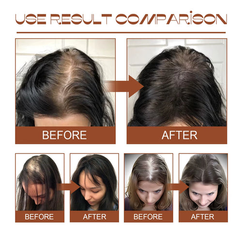 100% Pure Organic Hair Mask Batana Oil Hair Growth Oil Natural Treatment Nourish Reduce Hair Loss Anti-Breakage Hair Products